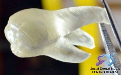 Crean dientes en 3D para combatir la placa bacteriana