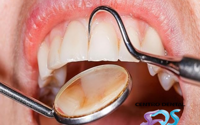 Cuándo llevar al niño al dentista por primera vez
