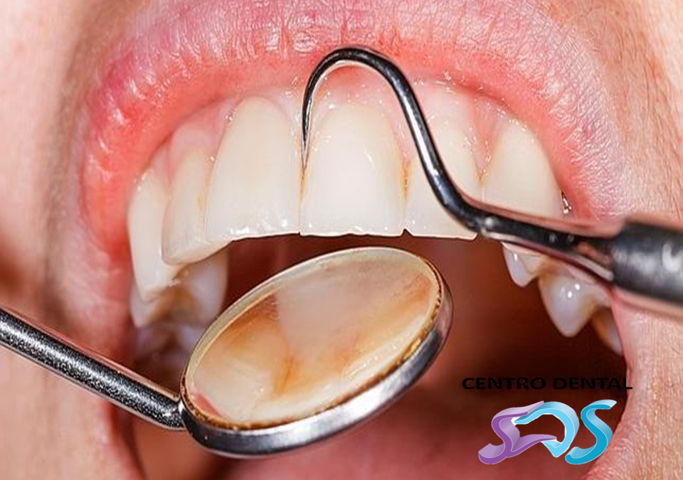 Cuándo llevar al niño al dentista por primera vez