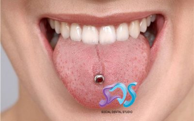 Piercing en la boca: los riesgos para los dientes