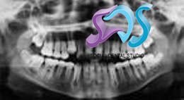 Dentistas en Chamberí Social Dental Studio Madrid radiografia