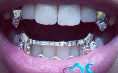 Conoce la moda de los grills
