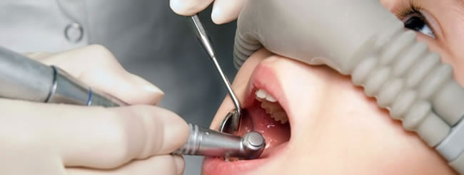 Dentistas en Chamberí Social Dental Studio Madrid sedation