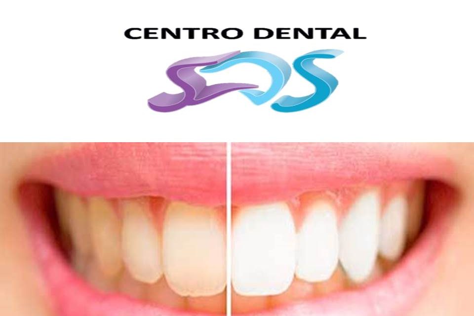 Dentistas en Chamberí Social Dental Studio Madrid BLANQ.