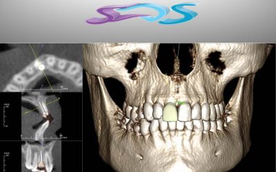 RADIOLOGIA EN ODONTOLOGIA