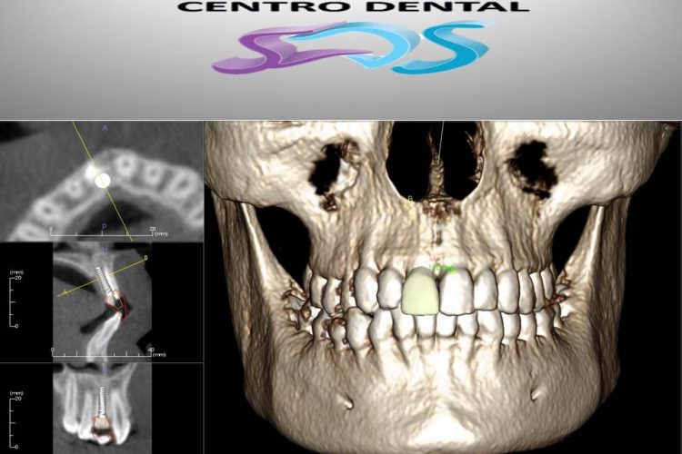 Dentistas en Chamberí Social Dental Studio Madrid Diapositiva1 2