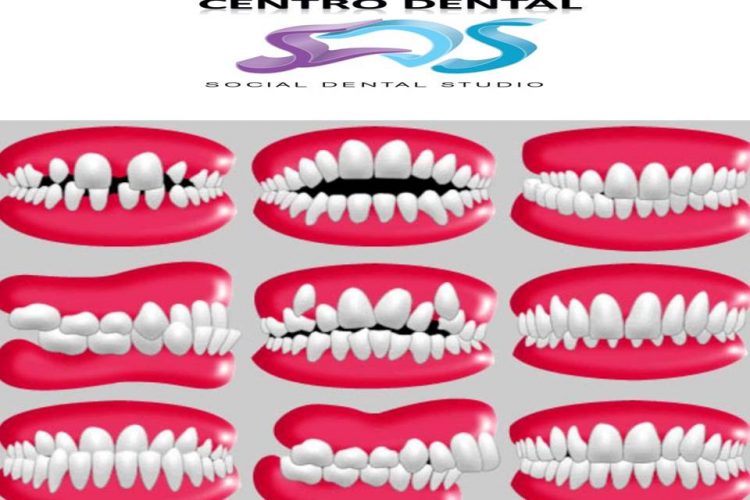 Dentistas en Chamberí Social Dental Studio Madrid Diapositiva1 5