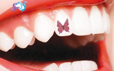 MODAS DENTALES