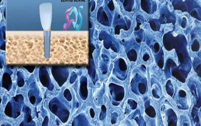 ¿Qué relación existe entre la osteoporosis y la salud dental?