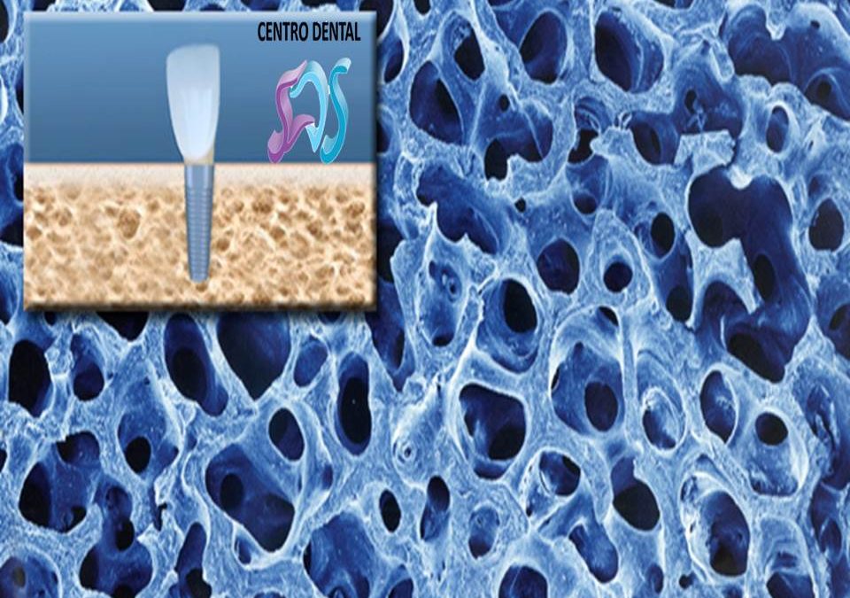 ¿Qué relación existe entre la osteoporosis y la salud dental?