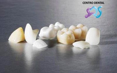LOS DIENTES PROVISIONALES ¿POR QUÉ SON IMPORTANTES?
