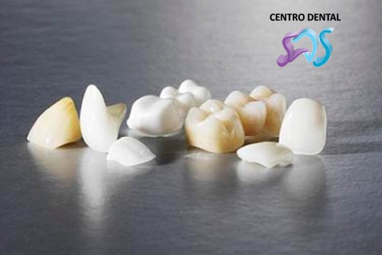 Dentistas en Chamberí Social Dental Studio Madrid PROVISIONALES 1