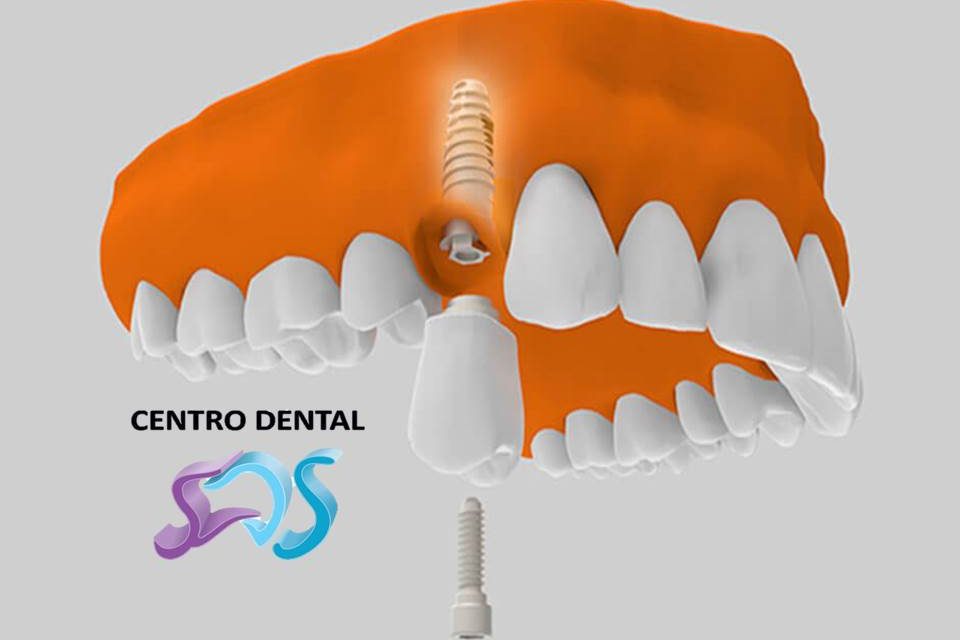 Dentistas en Chamberí Social Dental Studio Madrid PresentaciÃ³n1 2