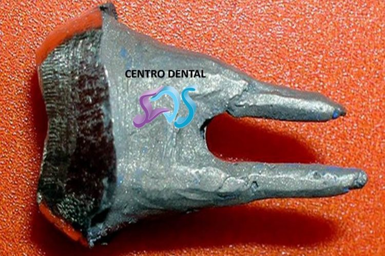 Dentistas en Chamberí Social Dental Studio Madrid PresentaciÃ³n1