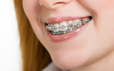 MITOS Y CURIOSIDADES DE LOS BRACKETS