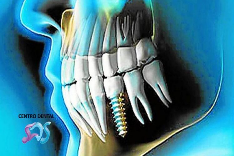 Dentistas en Chamberí Social Dental Studio Madrid Presentación1 768x576