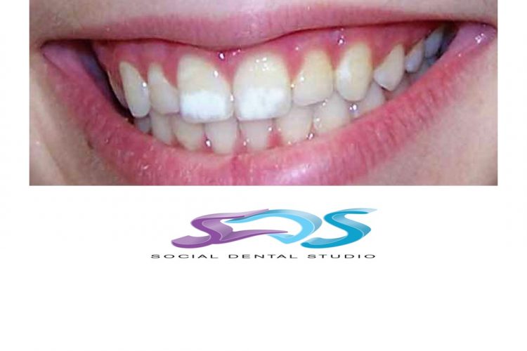 Dentistas en Chamberí Social Dental Studio Madrid Presentación1 4