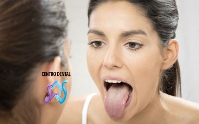 LEUCOPLASIA ORAL ¿Qué es?