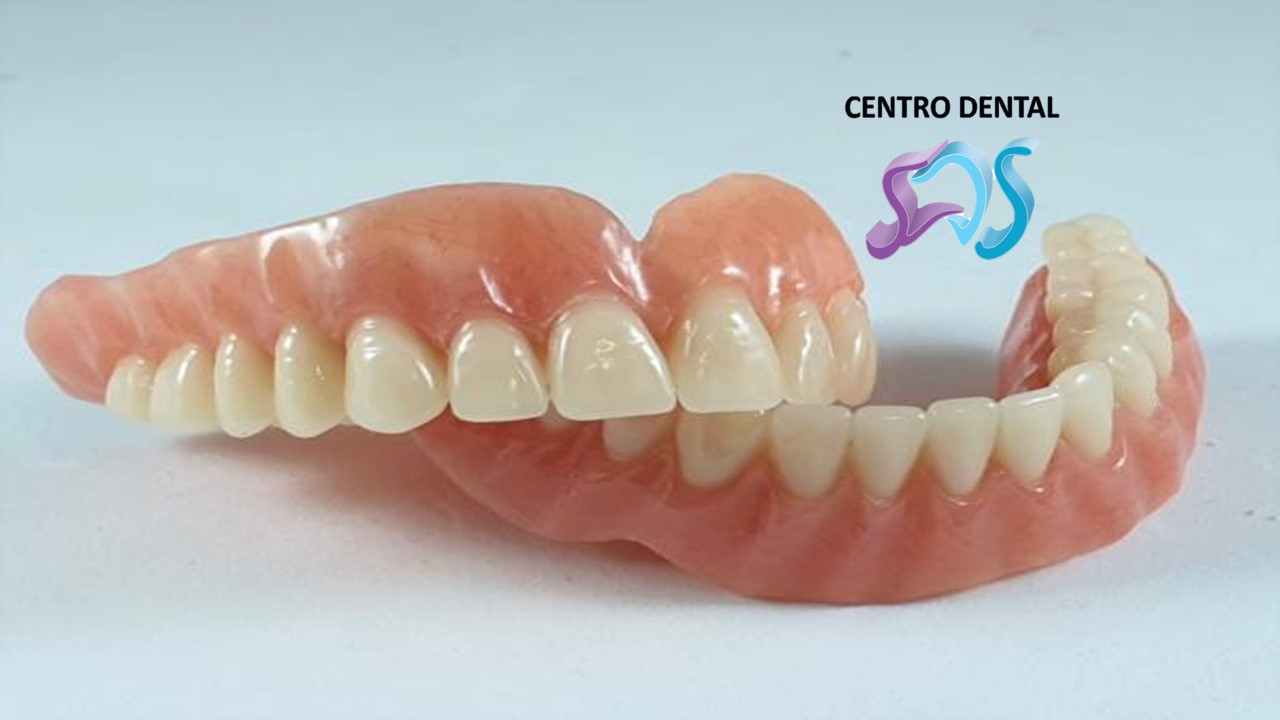 dientes