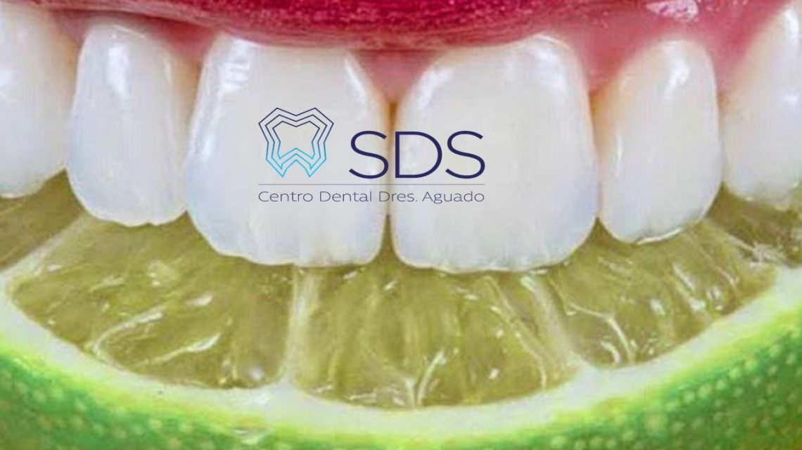 Dentistas en Chamberí Social Dental Studio Madrid LIMON