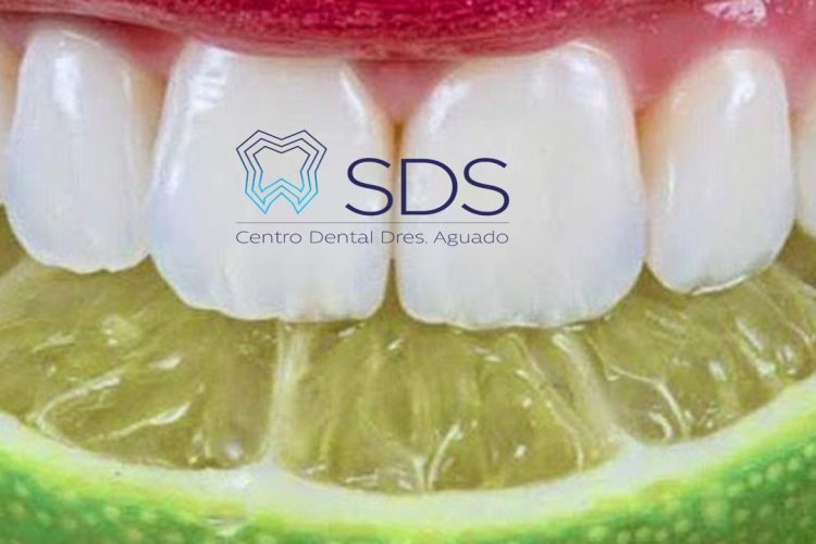 Dentistas en Chamberí Social Dental Studio Madrid LIMON