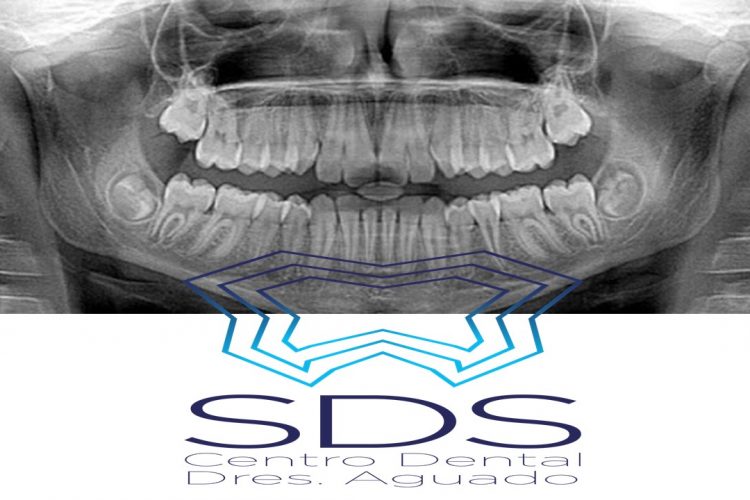 Dentistas en Chamberí Social Dental Studio Madrid sds